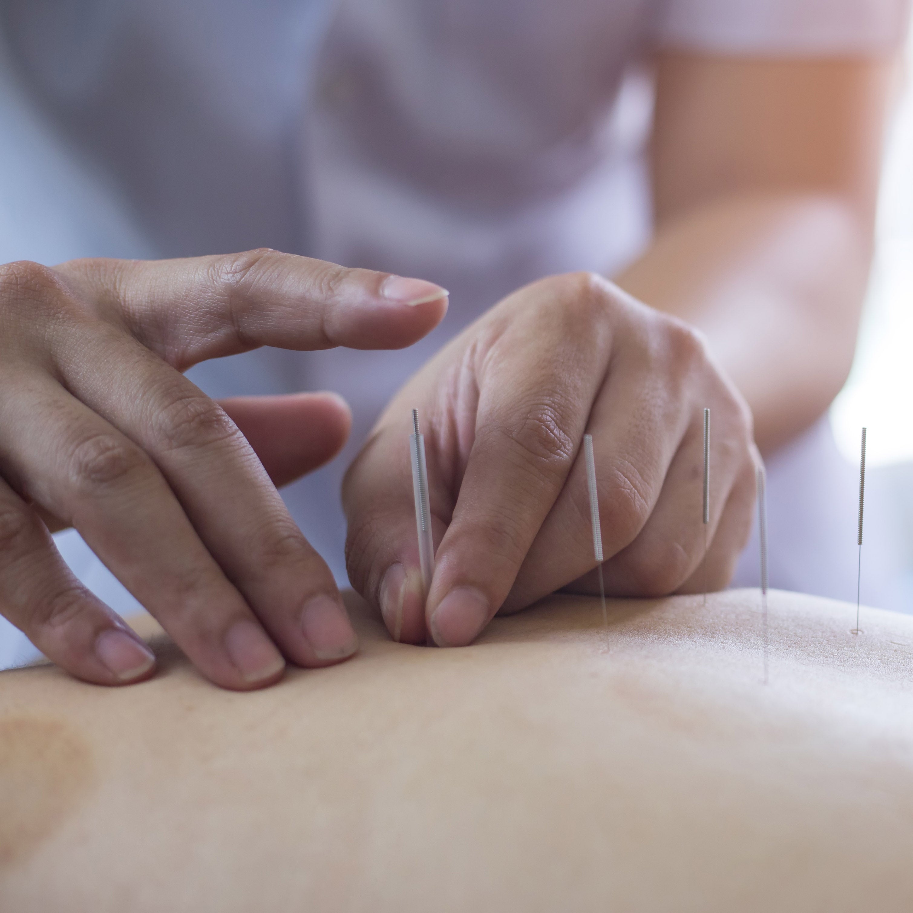 How Does Acupuncture Work?