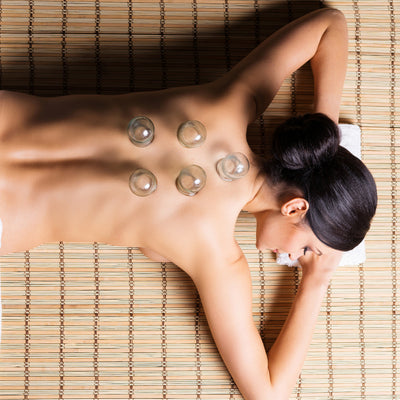 What Is Cupping Therapy & Can It Help You Recover Quicker?